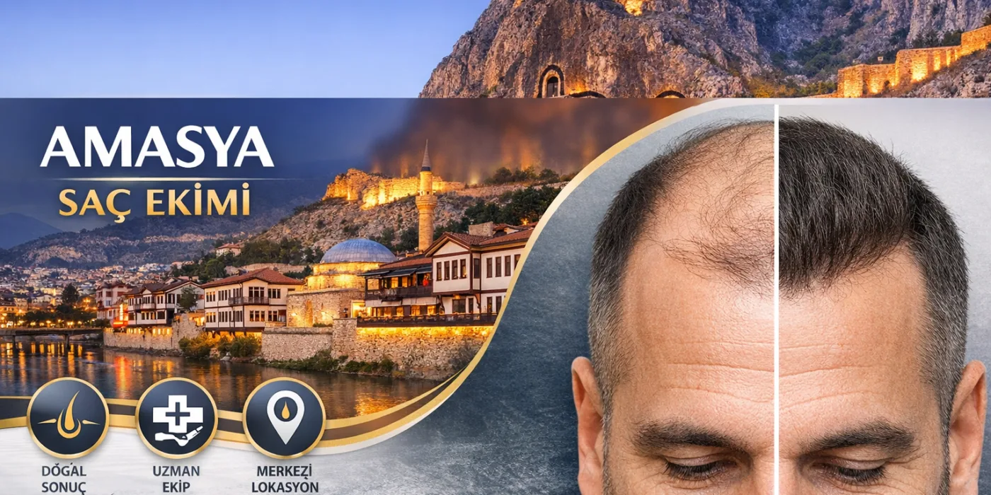 Amasya Saç Ekimi