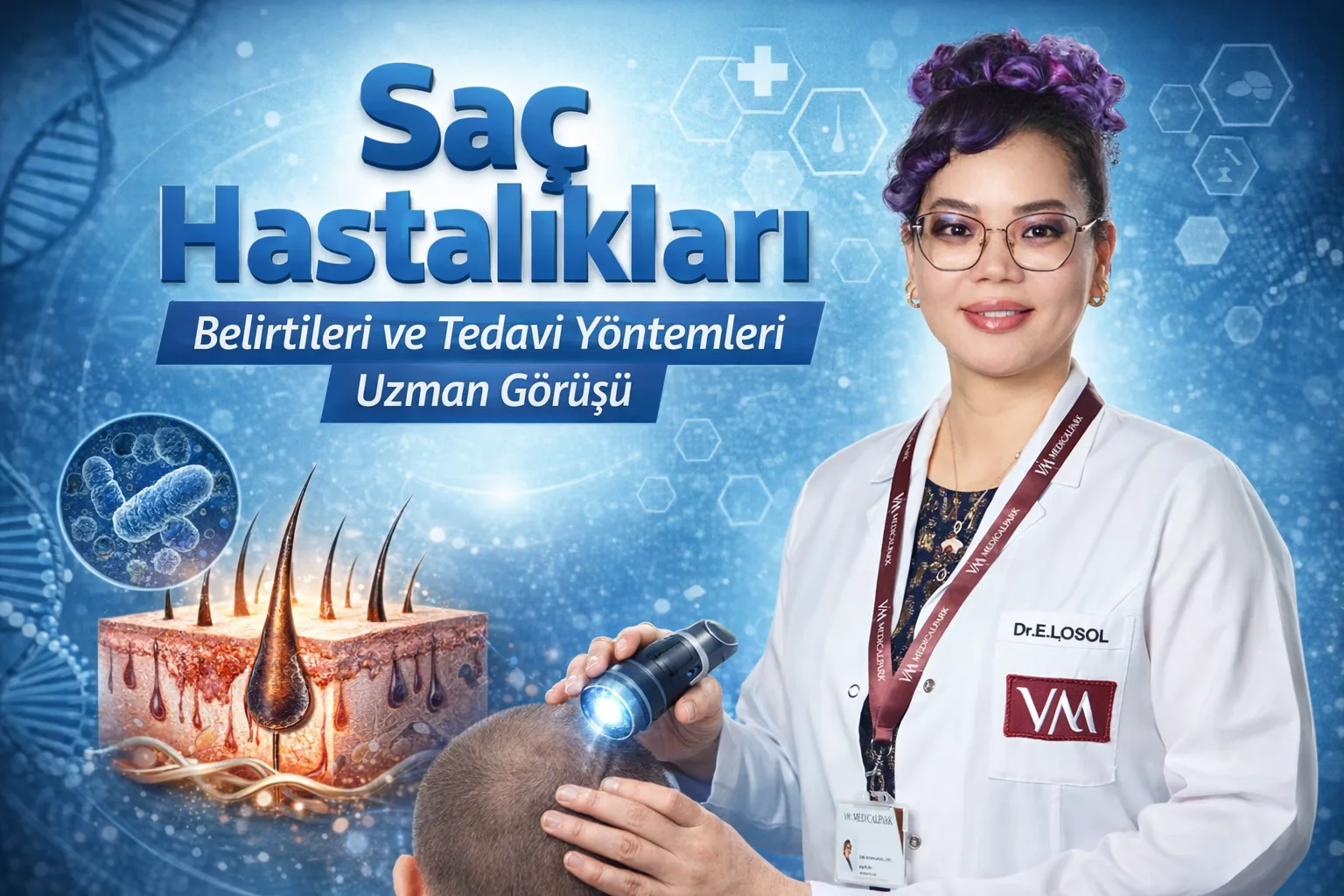 Saç Hastalıkları